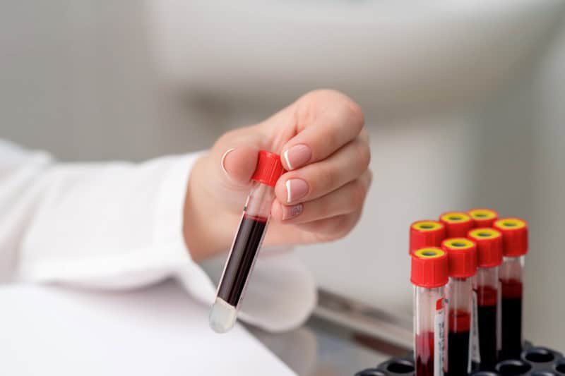 A hand in a white robe holding taking one blood test tube from her tray of blood tests